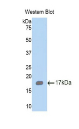Western blot of recombinant HEXB.