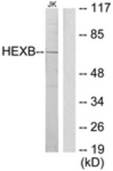 Western blot of extracts from Jurkat cells, using HEXB Antibody. The lane on the right is treated with the synthesized peptide.