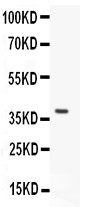 HEXB antibody Western blot. All lanes: Anti HEXB at 0.5 ug/ml. WB: Recombinant Human HEXB Protein 0.5ng. Predicted band size: 38 kD. Observed band size: 38 kD.