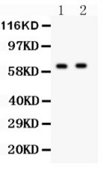 HEXB antibody Western blot. All lanes: Anti HEXB at 0.5 ug/ml. Lane 1: HELA Whole Cell Lysate at 40 ug. Lane 2: HEPG2 Whole Cell Lysate at 40 ug. Predicted band size: 63 kD. Observed band size: 63 kD.
