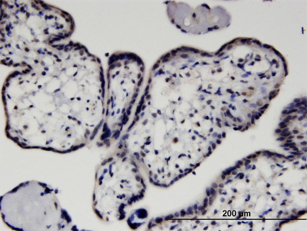 Immunoperoxidase of monoclonal antibody to HEXIM1 on formalin-fixed paraffin-embedded human placenta. [antibody concentration 1.5 ug/ml]