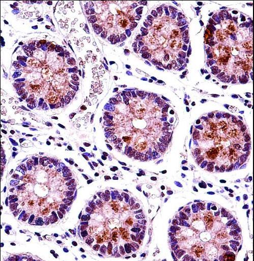 HEXIM1 Antibody immunohistochemistry of formalin-fixed and paraffin-embedded human colon tissue followed by peroxidase-conjugated secondary antibody and DAB staining.