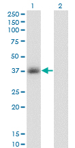 Western Blot analysis of GPD1 expression in transfected 293T cell line by GPD1 monoclonal antibody (M01), clone 3C10-1C4.Lane 1: GPD1 transfected lysate (Predicted MW: 37.6 KDa).Lane 2: Non-transfected lysate.