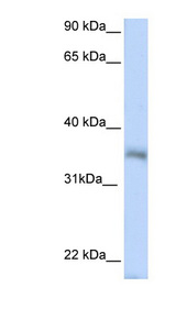 HEXIM2 antibody LS-C110607 Western blot of 721_B cell lysate.