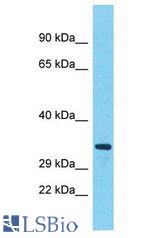 HEY1 antibody Western Blot of Fetal Kidney. Antibody dilution: 1 ug/ml.