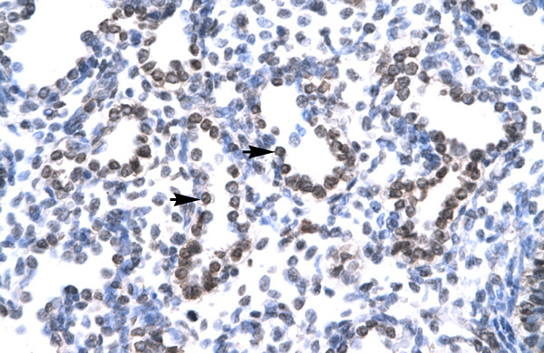 HEY1 antibody Western Blot of Human Lung Cellular Data: Alveolar cells Antibody Concentration: 4.