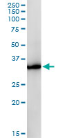 GPD1 monoclonal antibody (M01), clone 3C10-1C4. Western Blot analysis of GPD1 expression in human kidney.