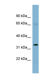 HEY1 antibody LS-C107603 Western blot of Fetal Stomach lysate.