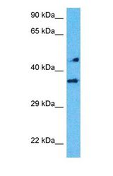 Western blot of HEY1 Antibody with human MCF7 Whole Cell lysate.