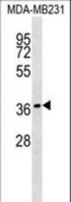 HEYL Antibody western blot of MDA-MB231 cell line lysates (35 ug/lane). The HEYL antibody detected the HEYL protein (arrow).
