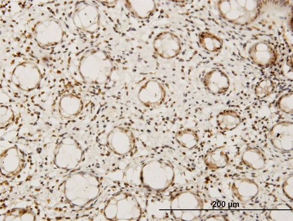 Immunoperoxidase of monoclonal antibody to HEYL on formalin-fixed paraffin-embedded human colon. [antibody concentration 1.5 ug/ml]