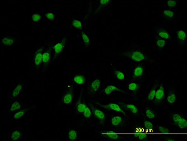 Immunofluorescence of monoclonal antibody to HEYL on HeLa cell. [antibody concentration 10 ug/ml]