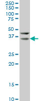 HEYL monoclonal antibody (M07), clone 1F6 Western blot of HEYL expression in HeLa.