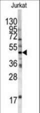Western blot of HFE antibody in Jurkat cell line lysates (35 ug/lane). HFE (arrow) was detected using the purified antibody.