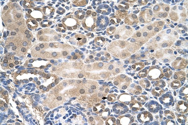 HFE antibody LS-C40466 IHC of formalin-fixed, paraffin-embedded human Kidney. Positive label: Epithelial cells of renal tubule indicated with arrows. Antibody concentration 4-8 ug/ml. Magnification 400X.