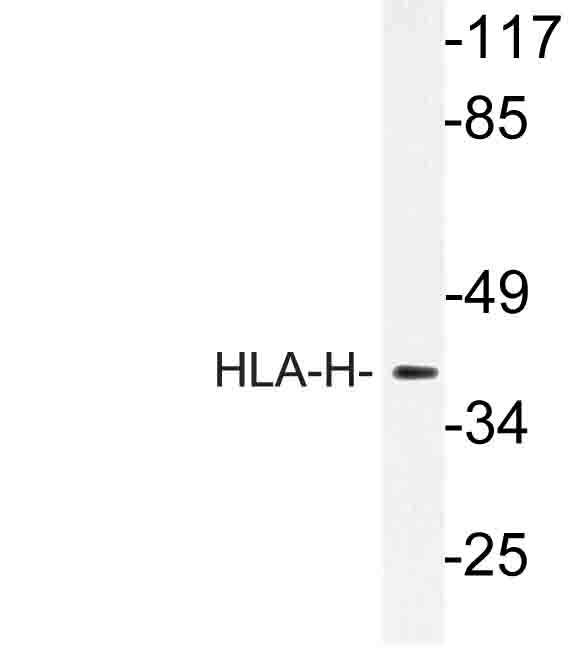 Western blot of HLA-H (I104) pAb in extracts from LOVO cells.