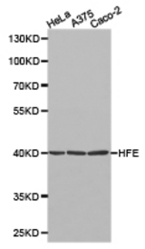 Western blot of extracts of various cell lines, using HFE antibody.