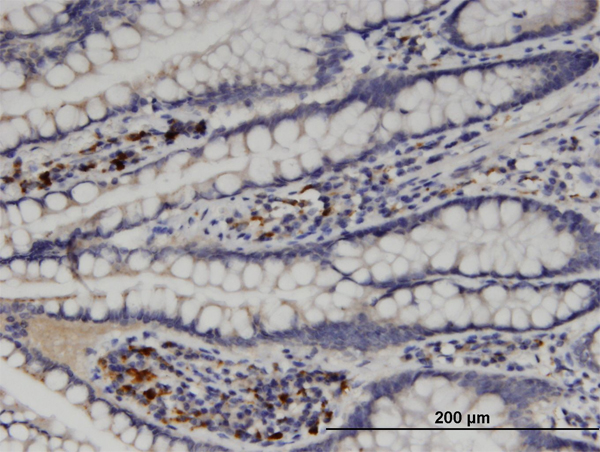 Immunoperoxidase of monoclonal antibody to MGAT5 on formalin-fixed paraffin-embedded human small Intestine. [antibody concentration 3 ug/ml]