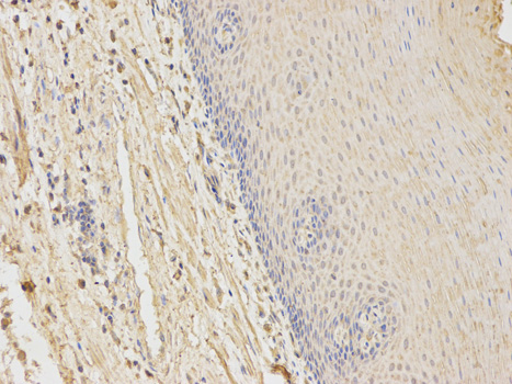 Immunohistochemistry of paraffin-embedded human esophagus using HFE antibody at dilution of 1:100 (200x lens).