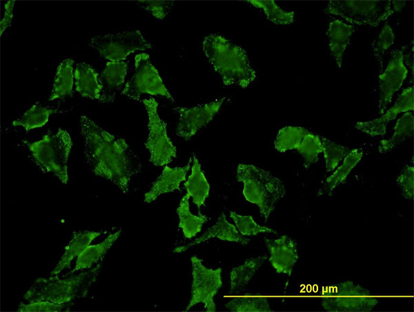 Immunofluorescence of monoclonal antibody to HFE on HeLa cell. [antibody concentration 10 ug/ml]