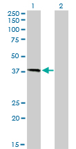 Western Blot analysis of HFE expression in transfected 293T cell line by HFE monoclonal antibody (M01), clone 1G12.Lane 1: HFE transfected lysate(40.1 KDa).Lane 2: Non-transfected lysate.
