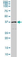HFE monoclonal antibody (M01), clone 1G12. Western Blot analysis of HFE expression in A-431.