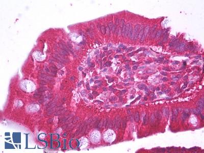 Anti-HFE2 antibody IHC of human small intestine. Immunohistochemistry of formalin-fixed, paraffin-embedded tissue after heat-induced antigen retrieval. Antibody LS-B7222 concentration 5 ug/ml.
