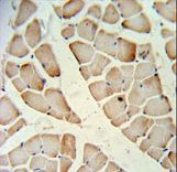 HFE2 Antibody IHC of formalin-fixed and paraffin-embedded skeletal muscle followed by peroxidase-conjugated secondary antibody and DAB staining.