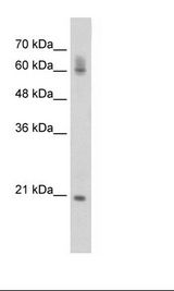 Jurkat Cell Lysate
