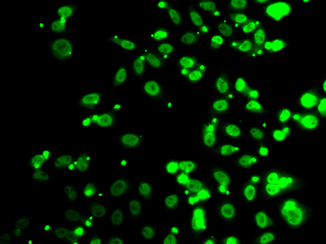 Immunofluorescence blot of A549 cell using FIP1L1 antibody.