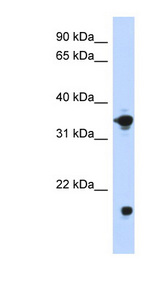 GPD1 antibody LS-C101949 Western blot of Transfected 293T cell lysate.