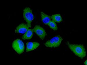 Immunofluorescent staining of HepG2 cells using anti-HGD antibody.