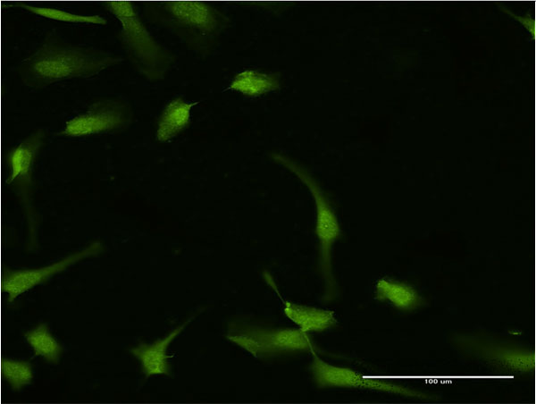 Immunofluorescence of monoclonal antibody to HGD on HeLa cell . [antibody concentration 10 ug/ml]