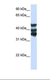 Hela cell lysate. Antibody concentration: 1.0 ug/ml. Gel concentration: 12%.
