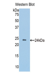 Western blot of recombinant HGD.