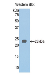 Western blot of recombinant HGD.