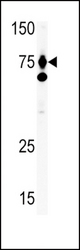 The anti-HGF antibody is used in Western blot to detect HGF in Ramos tissue lysate. HGF (arrow) was detected using the purified antibody.