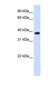 GPD1L antibody LS-C102593 Western blot of Fetal Muscle lysate.