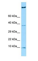HGSNAT antibody Western Blot of OVCAR-3.