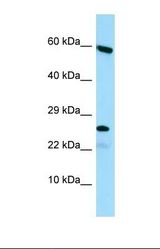 Western blot of Human HepG2. HGSNAT antibody dilution 1.0 ug/ml.