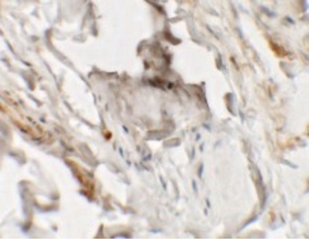 Immunohistochemistry of HHATL in human skin tissue with HHATL antibody at 2.5 ug/ml.