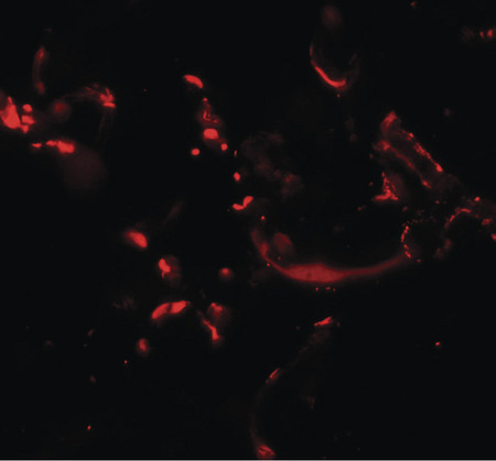 Immunofluorescence of HHATL in human skin tissue with HHATL antibody at 20 ug/ml.