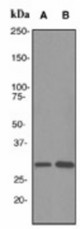 Western blot analysis on (A) MCF-7 and (B) A549 cell lysates using anti-Hex antibody (LS-C105532), dilution 1:2000.