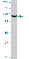 MGAT5 monoclonal antibody (M09), clone 3E9. Western blot of MGAT5 expression in Jurkat.