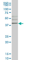 HHEX monoclonal antibody (M01), clone 3F11. Western Blot analysis of HHEX expression in human placenta.
