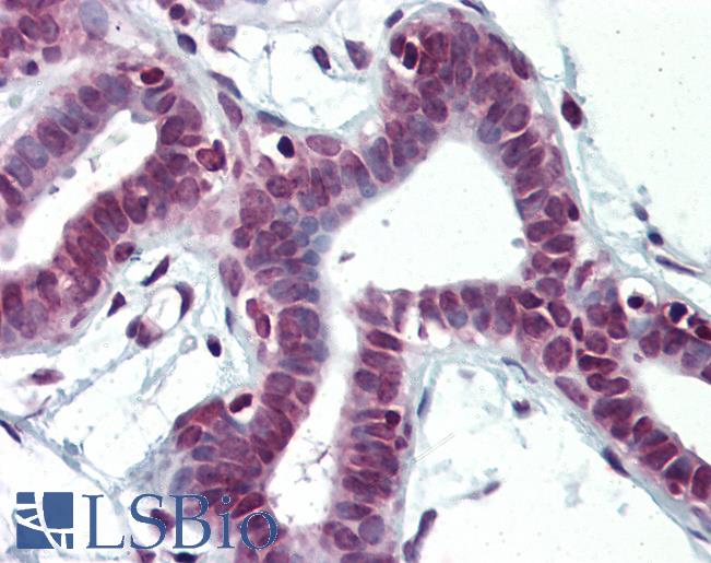 Anti-HHEX antibody IHC of human breast. Immunohistochemistry of formalin-fixed, paraffin-embedded tissue after heat-induced antigen retrieval. Antibody LS-B3077 concentration 5 ug/ml.