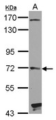 Sample (30 ug of whole cell lysate) A: NT2D1 7.5% SDS PAGE HHIP antibody diluted at 1:1000