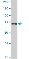 HHIP monoclonal antibody (M01), clone 5D11. Western blot of HHIP expression in MCF-7.
