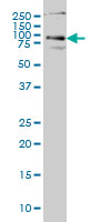 HHIP monoclonal antibody (M01), clone 5D11 Western blot of HHIP expression in HeLa NE.