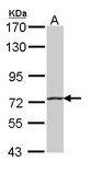 Sample (30 ug of whole cell lysate). A: A431 . 7.5% SDS PAGE. HHIP / HIP antibody diluted at 1:1000.